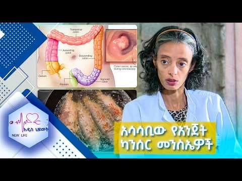 አሳሳቢው የአንጀት ካንሰር መንስኤዎች.../New Life